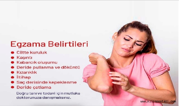 Egzama Nedir ? Belirtileri nelerdir?
