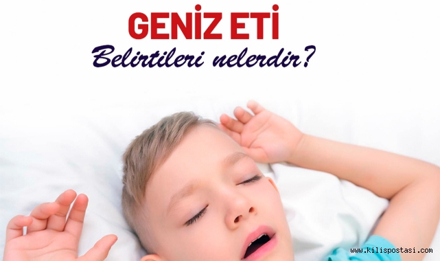 Geniz Eti belirtileri nelerdir?
