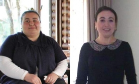 Dengeli Diyetle 58 Kilo Verdi!